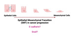 A Molecular Mechanism of Epithelial to Mesenchymal Transition (EMT): An Evidence Based Lesson Applying Molecular Biology Through the Lens of Cancer